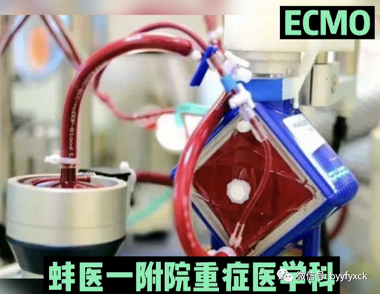 ���t(y��)һ��Ժ�\(y��n)�Ï�(f��)�sΣ�������K��Ĥ���g(sh��)����؞ECMO���g(sh��)�ɹ���������һ������